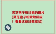 灵芝孢子粉过敏的图片(灵芝孢子粉致敏反应！看看这些过敏症状)
