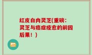 红皮白肉灵芝(重磅：灵芝与癌症痊愈的前因后果！)