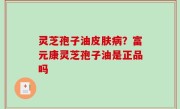 灵芝孢子油皮肤病？富元康灵芝孢子油是正品吗