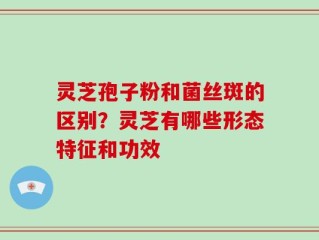 灵芝孢子粉和菌丝斑的区别？灵芝有哪些形态特征和功效