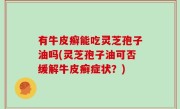 有牛皮癣能吃灵芝孢子油吗(灵芝孢子油可否缓解牛皮癣症状？)