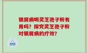 银屑病喝灵芝孢子粉有用吗？探究灵芝孢子粉对银屑病的疗效？