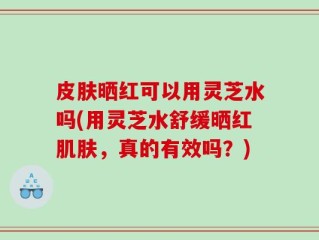 皮肤晒红可以用灵芝水吗(用灵芝水舒缓晒红肌肤，真的有效吗？)