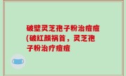 破壁灵芝孢子粉治痘痘(破红颜祸首，灵芝孢子粉治疗痘痘