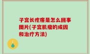 子宫长疙瘩是怎么回事图片(子宫肌瘤的成因和治疗方法)