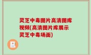 灵芝中毒图片高清图库视频(高清图片库展示灵芝中毒场面)