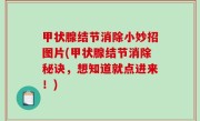 甲状腺结节消除小妙招图片(甲状腺结节消除秘诀，想知道就点进来！)