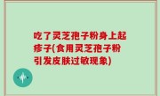 吃了灵芝孢子粉身上起疹子(食用灵芝孢子粉引发皮肤过敏现象)