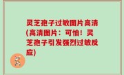灵芝孢子过敏图片高清(高清图片：可怕！灵芝孢子引发强烈过敏反应)