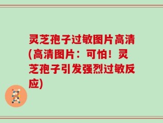 灵芝孢子过敏图片高清(高清图片：可怕！灵芝孢子引发强烈过敏反应)