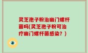 灵芝孢子粉治幽门螺杆菌吗(灵芝孢子粉可治疗幽门螺杆菌感染？)