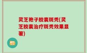 灵芝袍子胶囊斑秃(灵芝胶囊治疗斑秃效果显著)