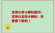 宫颈口有小颗粒图片(宫颈口出现小颗粒：你需要了解的 )