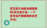 灵芝孢子油能治银屑病吗(灵芝孢子油：一个有效治疗银屑病的自然方法)