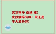灵芝孢子 皮肤 痒(皮肤瘙痒有救！灵芝孢子大放异彩)