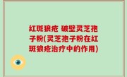 红斑狼疮 破壁灵芝孢子粉(灵芝孢子粉在红斑狼疮治疗中的作用)