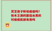 灵芝孢子粉祛痘痘吗？悦木之源的菌菇水真的对痘痘肌肤有用吗