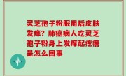 灵芝孢子粉服用后皮肤发痒？肺癌病人吃灵芝孢子粉身上发痒起疙瘩是怎么回事