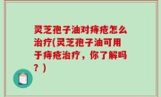 灵芝孢子油对痔疮怎么治疗(灵芝孢子油可用于痔疮治疗，你了解吗？)