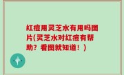 红痘用灵芝水有用吗图片(灵芝水对红痘有帮助？看图就知道！)