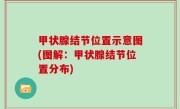 甲状腺结节位置示意图(图解：甲状腺结节位置分布)