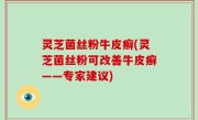 灵芝菌丝粉牛皮癣(灵芝菌丝粉可改善牛皮癣——专家建议)