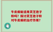 牛皮癣能适用灵芝孢子粉吗？探讨灵芝孢子粉对牛皮癣的治疗作用？
