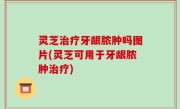 灵芝治疗牙龈脓肿吗图片(灵芝可用于牙龈脓肿治疗)
