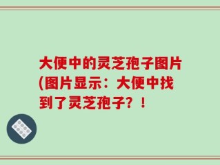 大便中的灵芝孢子图片(图片显示：大便中找到了灵芝孢子？！
