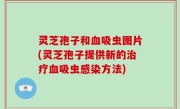 灵芝孢子和血吸虫图片(灵芝孢子提供新的治疗血吸虫感染方法)