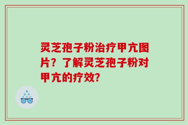 灵芝孢子粉甲亢图片？了解灵芝孢子粉对甲亢的疗效？