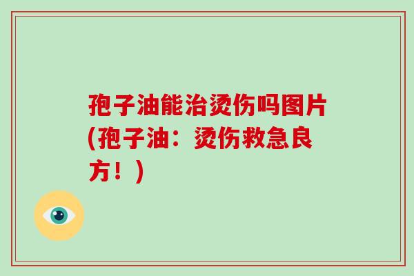 孢子油能烫伤吗图片(孢子油：烫伤救急良方！)