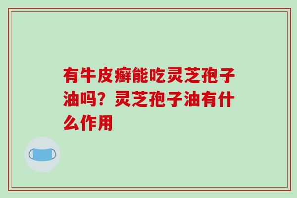 有牛皮癣能吃灵芝孢子油吗?灵芝孢子油有什么作用 有牛皮癣能吃灵芝孢子油吗?灵芝孢子油有什么作用