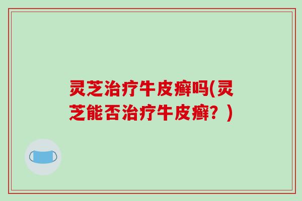 灵芝牛皮癣吗(灵芝能否牛皮癣?) 灵芝牛皮癣吗(灵芝能否牛皮癣?)